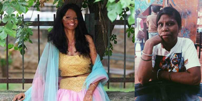 AN ACID ATTACK, A BITTER TRUTH OF MALE DOMINATED SOCIETY, WHERE NO, IS NOT TOLERABLE