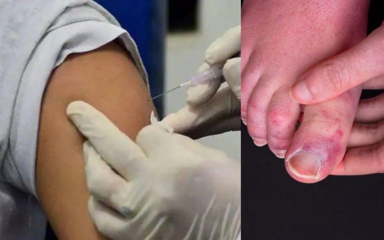 Covid Vaccination Side Effects